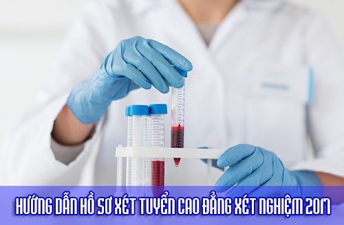 science, chemistry, biology, medicine and people concept - close up of young female scientist holding tube with blood sample making and test or research in clinical laboratory