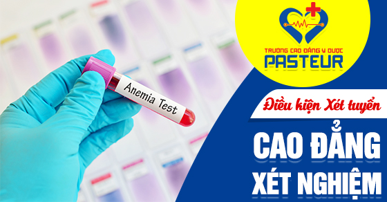 Điều kiện tuyển sinh Cao đẳng Xét nghiệm TPHCM năm 2021 là gì?